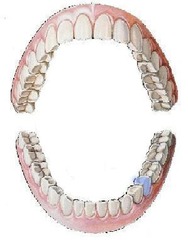 <p>mandibular left second bicuspid</p>