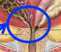 <p>Ejaculatory duct</p>