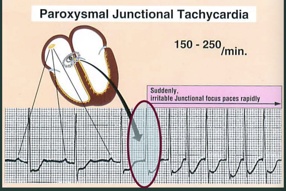 <p>What defines PJT?</p>
