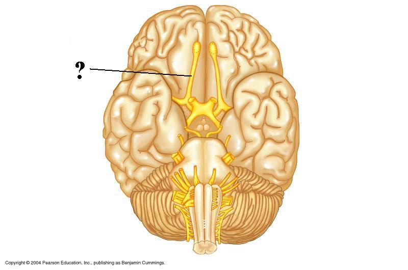 <p>Is the indicated structure composed of sensory neurons, motor neurons, or both?</p>