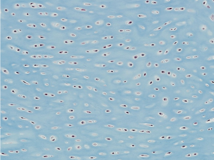 <p><span style="font-family: "Calibri Light";">Which type of CT is this?</span></p>