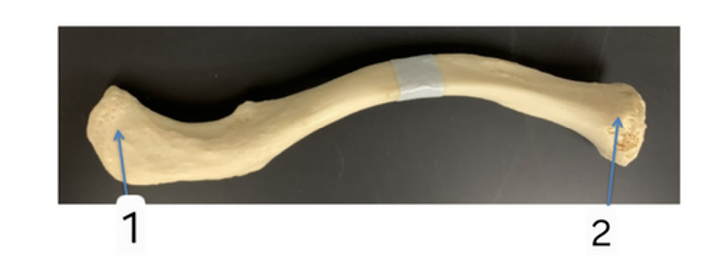 <p>what is this bone and what view are you looking at?</p>