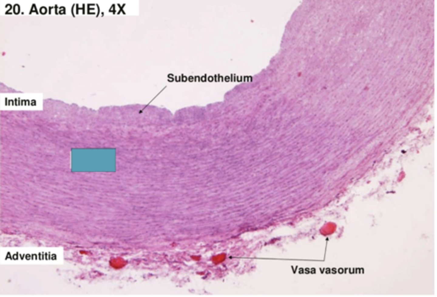 <p>Identify the layer of the vessel</p>
