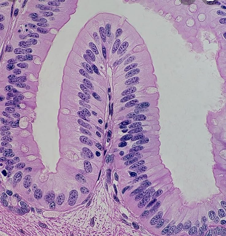 <p>Picture from the small intestine</p>