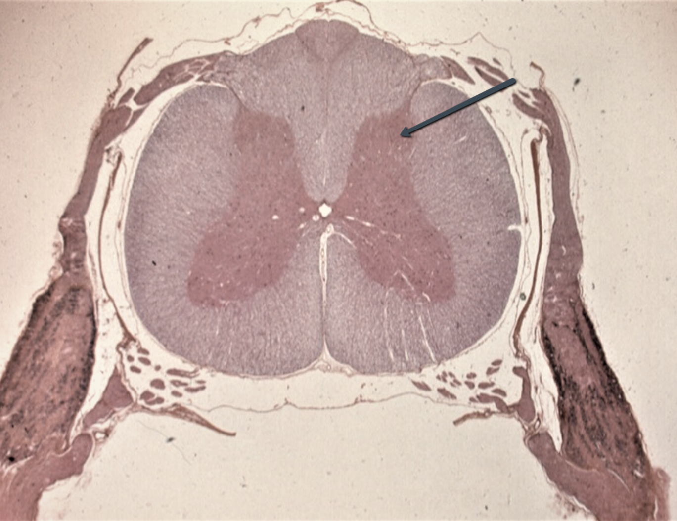 <p><span><strong>Identify the area indicated by the pointer.</strong></span></p>