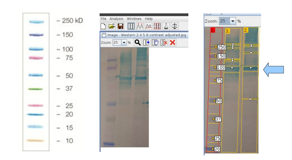 <ul><li><p>second lane = cleared lysate, third lane = purified protein</p></li><li><p>band of interest has a molecular weight of 104/102 kDA, which is close to the expected mass of 97kDA</p><ul><li><p>therefore, pretty confident this band is correct</p></li></ul></li><li><p>raw volume: lysate = 882, purified protein = 1084</p><ul><li><p>therefore 1084/882 = 1.2 x as much recombinant protein in purified lane as in cleared lysate lane</p></li></ul></li><li><p>the SDS-PAGE were loaded w/ 10µl of purified protein and ~3.8µl cleared lysate (3.8µl + 1.2 µl loading buffer)</p></li></ul><p></p>