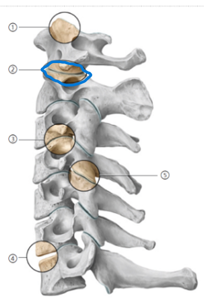 <p>What joint is this?</p>