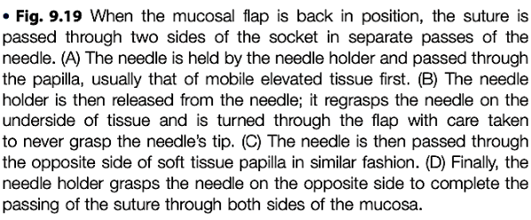 <p>passed from free to fixed tissue</p>