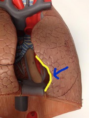 <p>Identify the structure</p>