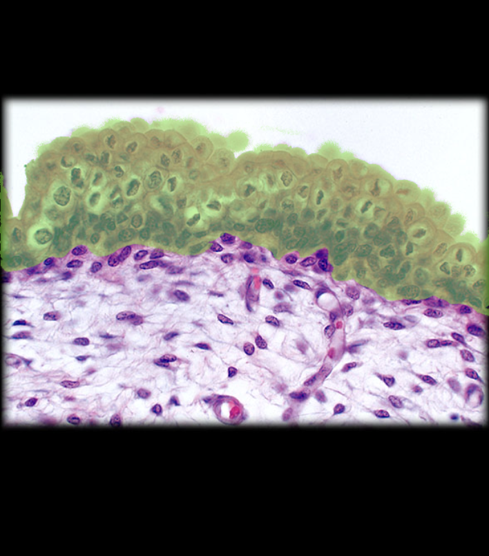 term image