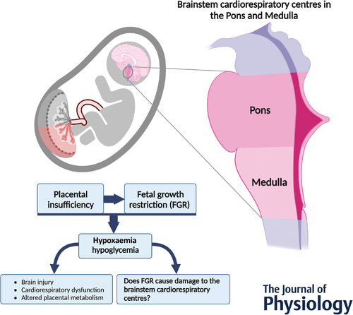 <p>high blood pressure, diabetes, blood clotting disorders, Anemia, heart/kidney problems, or smoking and drug use by the mother during pregnancy. </p>