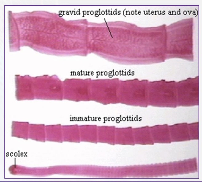 <p>Immature: Lack reproductive organs</p><p>Mature: Hermaphroditic, fully functional male and female parts</p><p>Gravid: Old detached segments filled with eggs</p>
