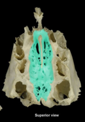 <p>Small holes in cribriform plate for olfactory nerves</p>