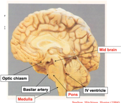 <p>The majority of the cranial nerves (except CNI and CNII) have nuclei that originate where?</p>
