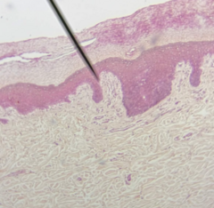 <p>What kind of tissue is this?</p>