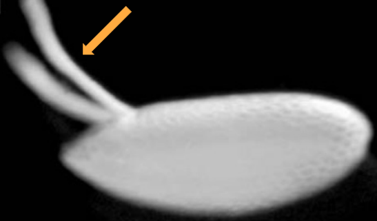 <p>Dorsal appendages</p>