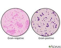 <p>Gram stain</p>