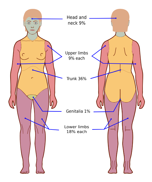 <p>Head = 9</p><p>Each arm = 9</p><p>Anterior torso = 18</p><p>Posterior torso = 18</p><p>Perineum = 1</p><p>Each leg =18</p>