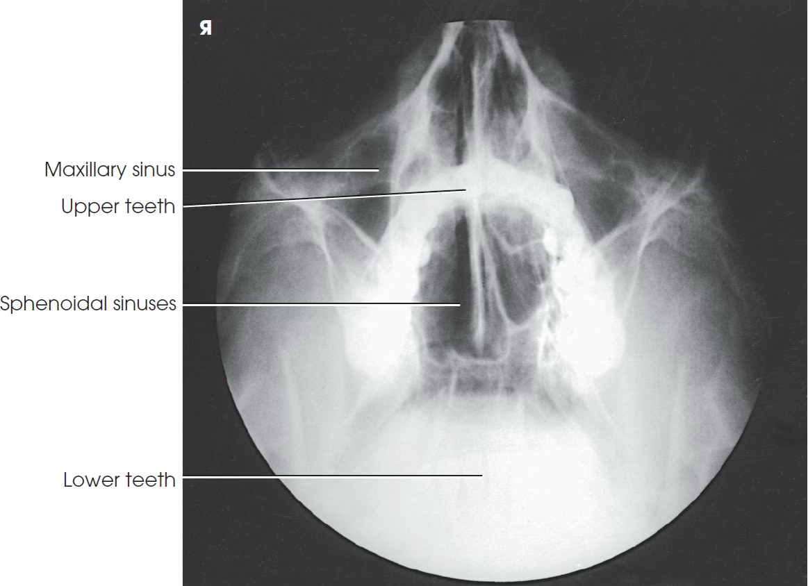 <p>What view is this?</p>