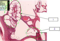 <p>What is the structure at 1</p>