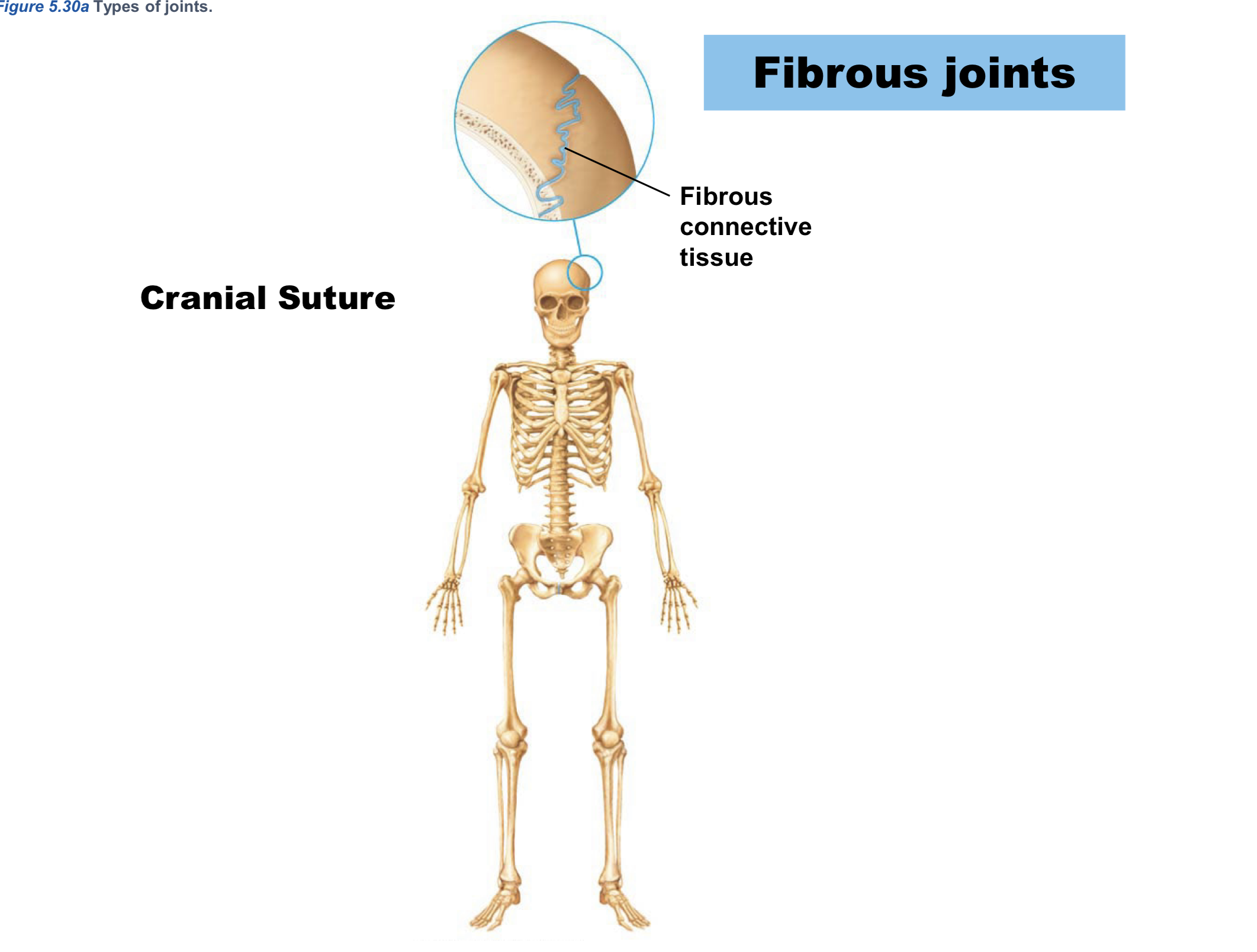 <p>Fibrous (STRUCTURAL joints) </p>