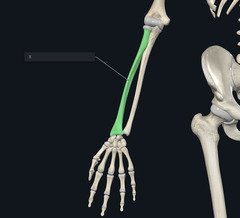 <p>Name the bone indicated by the X and highlighted green</p>