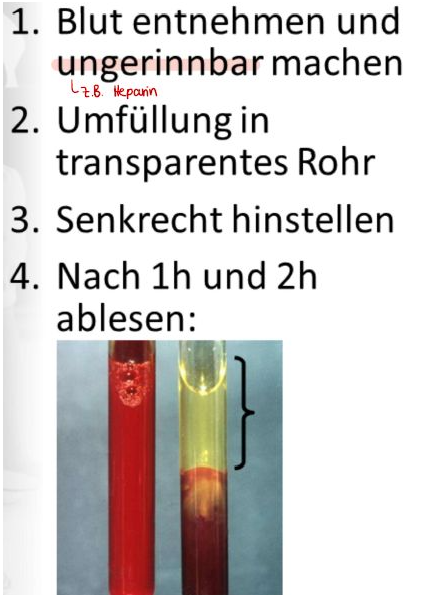 <ul><li><p>Meist wird zu Bestimmung der Blutsenkungsgeschwindigkeit (BSG) die <strong>Westergren-Methode</strong> angewendet:</p><ul><li><p><strong>1,6 ml Vollblut</strong> werden mit Natriumcitratlösung auf 2 ml aufgefüllt und damit ungerinnbar gemacht&nbsp;</p></li><li><p>Anschließend (d.h. nicht später als 2 Stunden nach Blutentnahme) wird mit diesem Citratblut ein Glas- oder Kunststoffröhrchen bis zur Höhe von 20 cm befüllt, senkrecht hingestellt und bei Zimmertemperatur in Ruhe gelassen.&nbsp;</p></li><li><p>Die geformten (=zellulären) Bestandteile sedimentieren nach unten (s.o.). Die sog. Senkung (= Höhe des durchsichtigen, da zellfreien, Überstandes, also das Plasma) wird nach einer und nach zwei Stunden abgelesen.&nbsp;</p></li></ul></li><li><p>Die BSG ist ein recht unspezifischer Parameter</p></li><li><p>Eine höhere BSG deutet auf Infektionen oder entzündliche Vorgänge hin</p></li><li><p>Grund: Einige Entzündungsprozesse im Körper können Erythrozyten dazu veranlassen, sich aneinanderzulagern (Clusterbildung)</p></li><li><p>Diese Cluster sinken aufgrund der geänderten Strömungsbedingungen schneller ab</p></li><li><p>Die Standardwerte für die BSG schwanken sehr</p><ul><li><p>Bei Nichtdifferenzierung (d.h. keine Unterscheidung nach Geschlecht und/oder Alter) finden sich Literatur-Referenzwerte nach der ersten Stunde von etwa 10 mm, nach der zweiten Stunde von etwa 20 mm.</p></li><li><p>Dies entspricht einer Sedimentationsgeschwindigkeit der Blutzellen von 2 bis 3 μm pro Sekunde.</p></li></ul></li></ul><p></p>