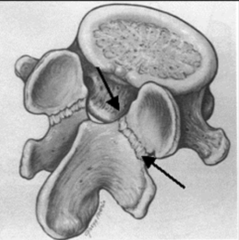 <p>What landmark is the black arrows indicating?</p>