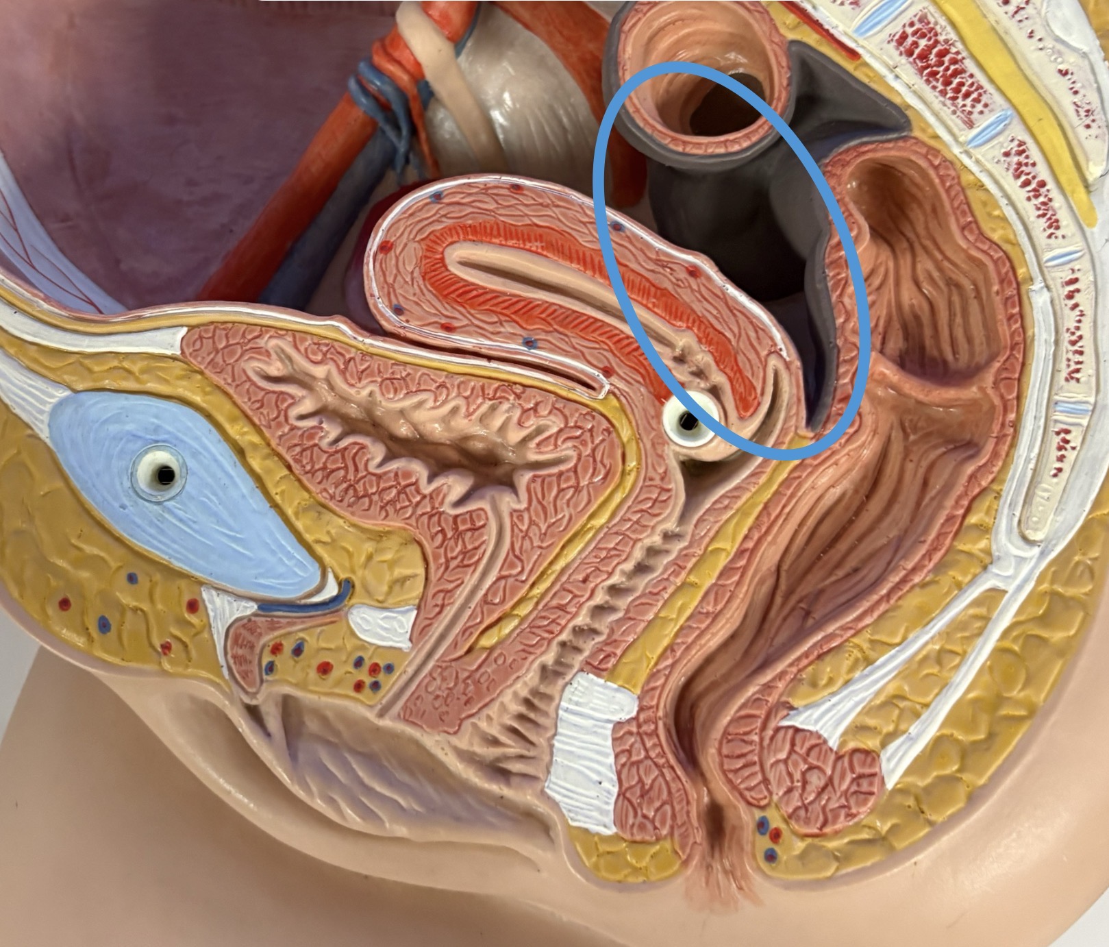 <p>pouch between rectum &amp; uterus </p>