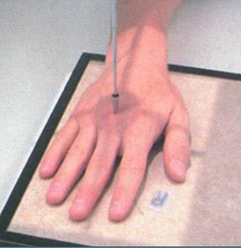 <p>The small metallic object on the medial side of the 1st and 2nd digit, is used for <strong>identification</strong> of that particular part of the anatomy. What is the name of that object? (answer in lower case)</p>