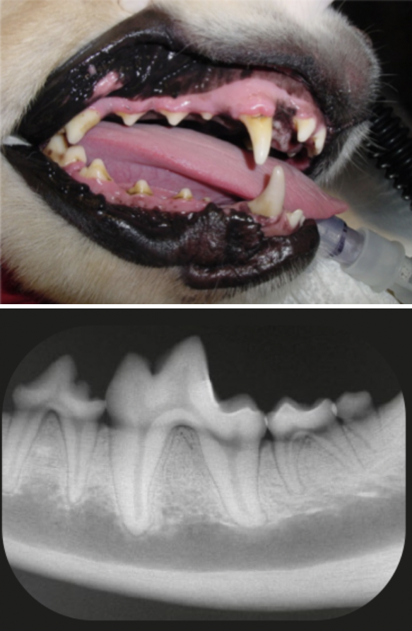 <p>What is the stage of periodontal disease shown in this image?</p>