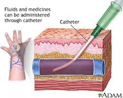 <p>The fastest and most accurate way to get drugs into circulation. Medication administred straight into a vein</p>