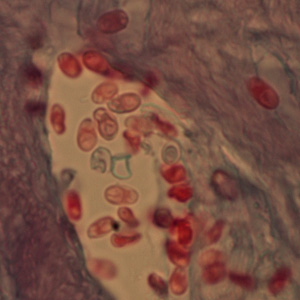 <p>Trichrome Stain of Corneal Section</p>