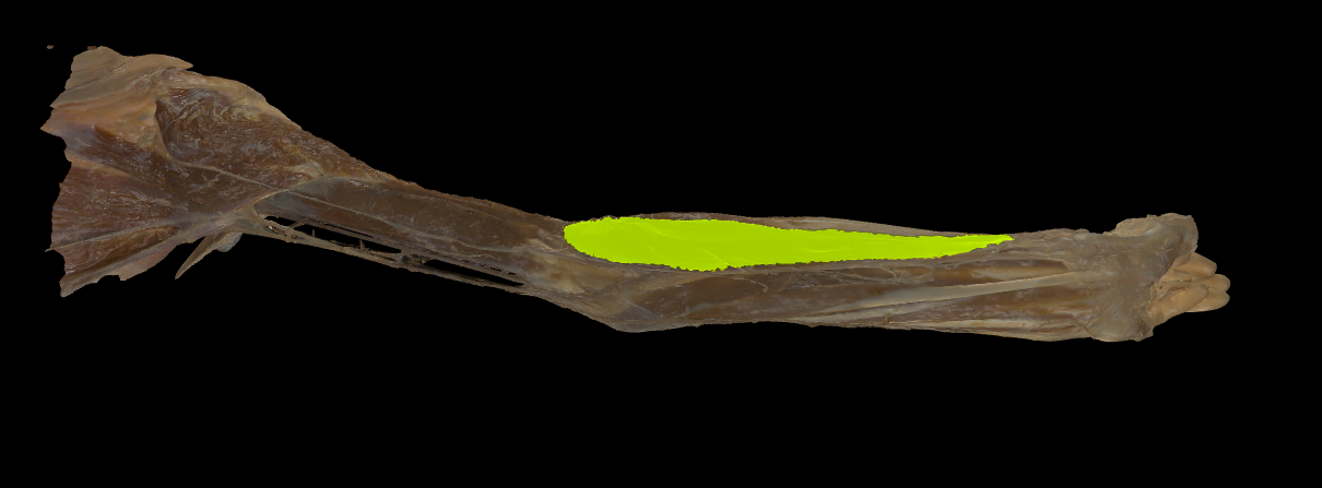 term image