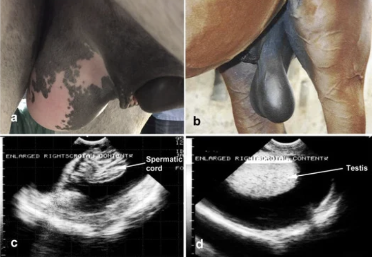<p>Hematocele: Pathophysiology</p>
