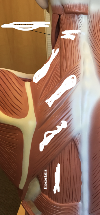 <p>Iliocostalis. </p>