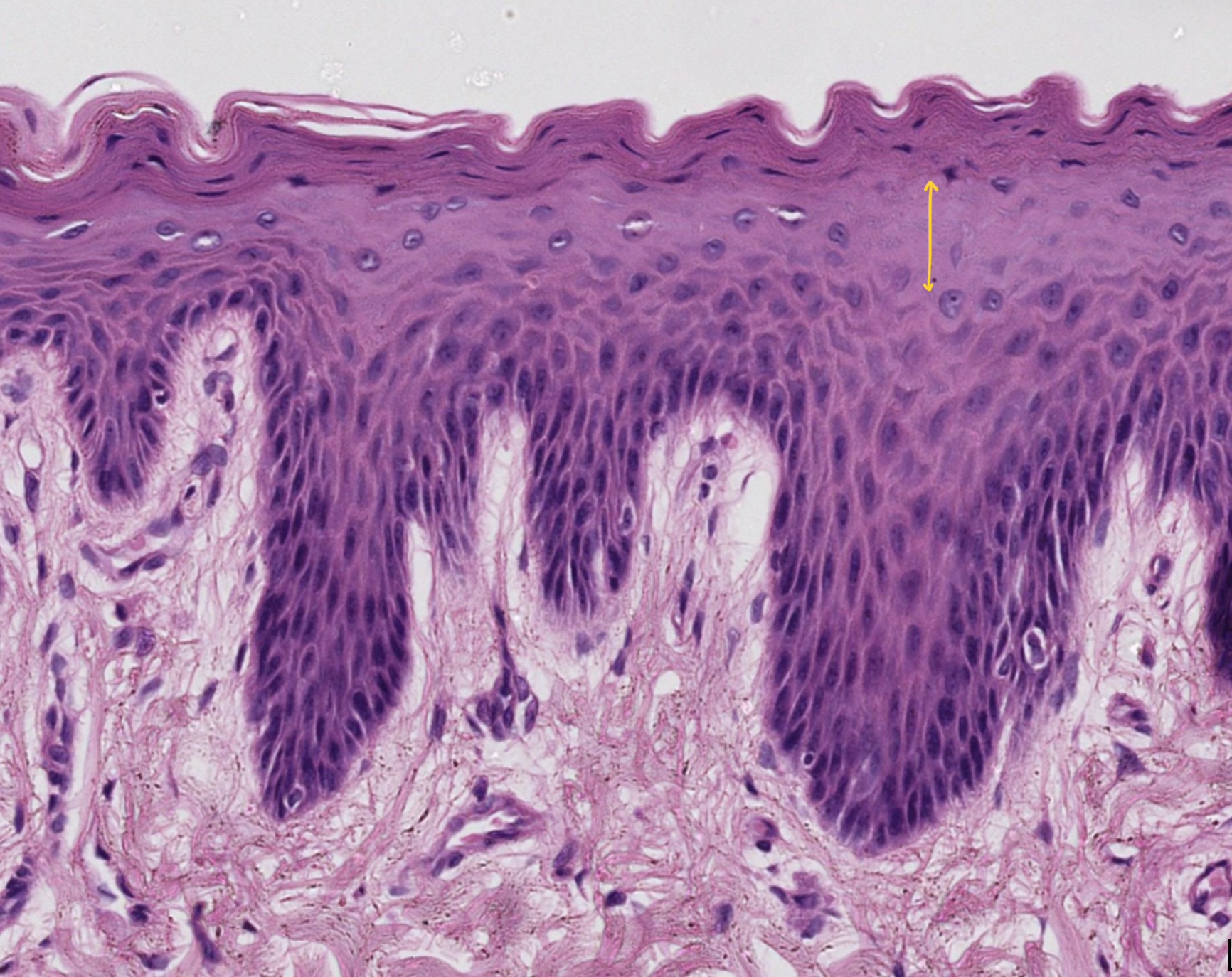 <p>multiple layers of cells with basophilic granules</p>