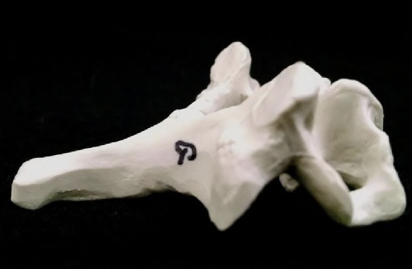 <p>what vertebrae is this?</p>