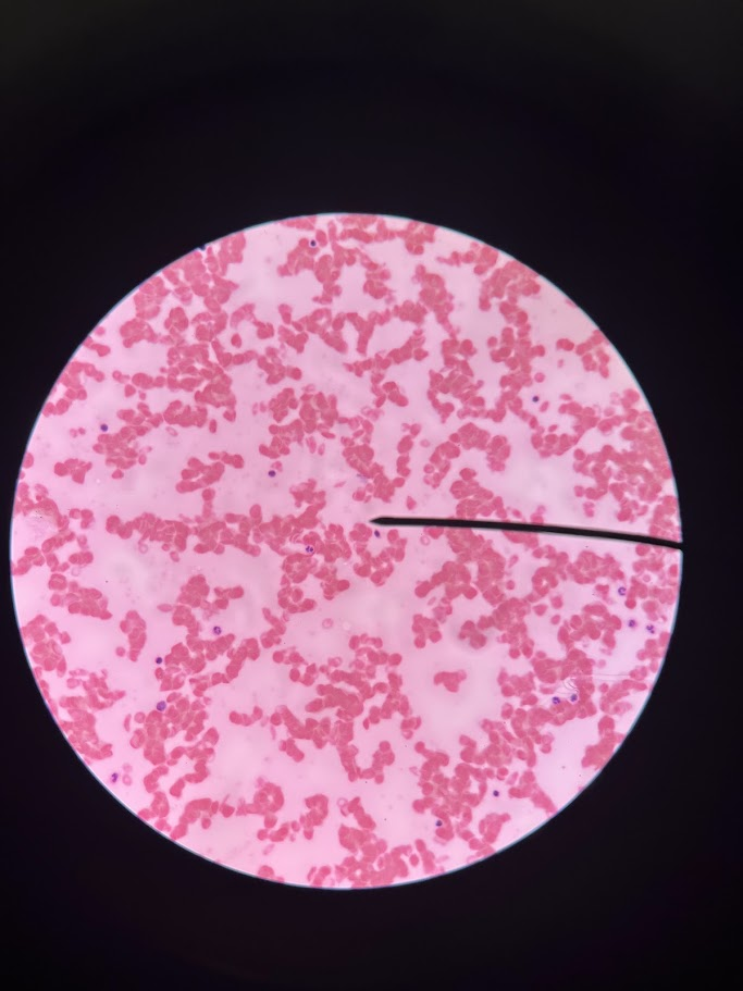<p>This slide depicts which type of anemia</p>