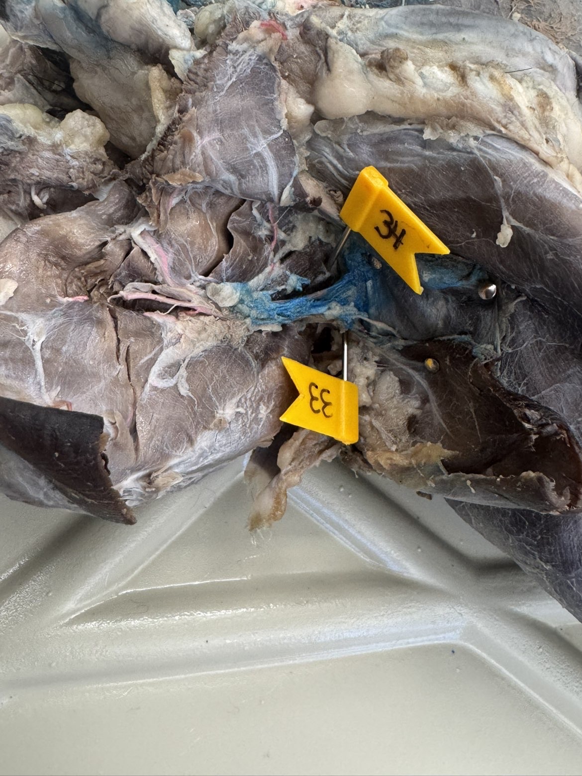 <p>Numbers:</p><p>33</p><p>34</p>