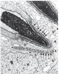 <p>What organelles are abundant or well-developed in Sertoli cells?</p>