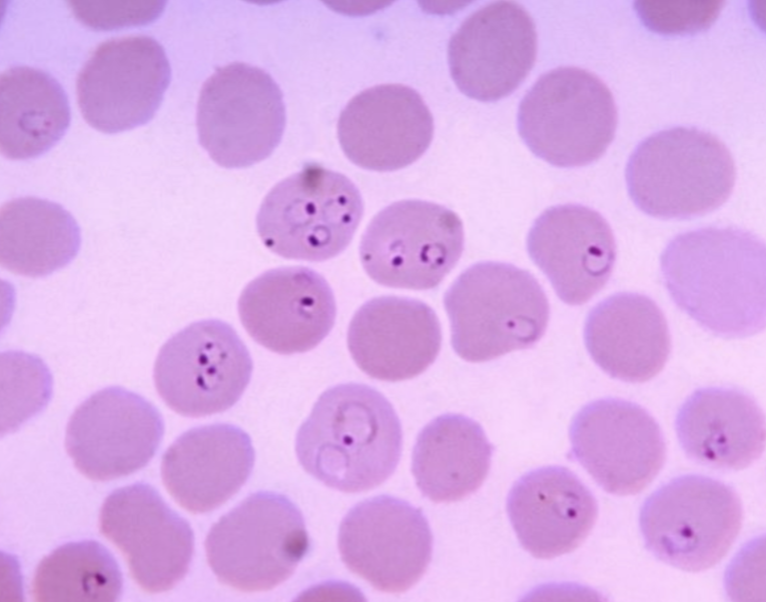 <p>What protist is this?</p>