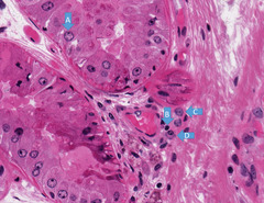 <p>Identify the cells</p>