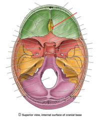 <p>What is the red arrow pointing to?</p>