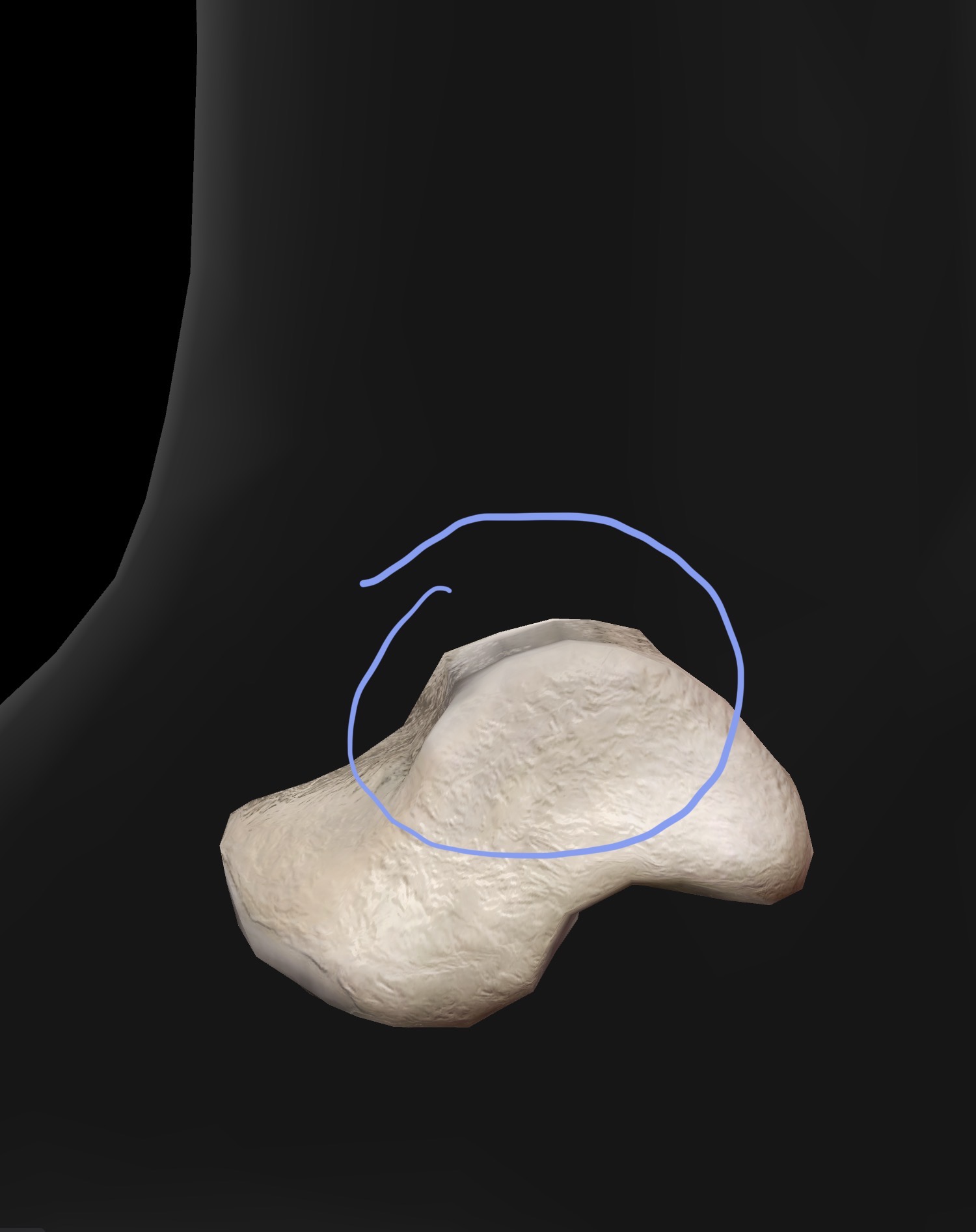 <p>Talar dome (trochlea) - rounded top of proximal aspect of the talus that articulates with the tibia and fibula to form the “talocrural“</p><p>The Talar dome can be palpated at the “top of the talus” best felt with the ankle (talocrural joint) in a plantar flexed position</p>