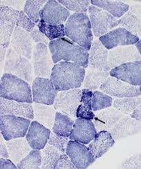 <p>succinic dehydrogenase (SDH) results:</p><p>blue: </p>