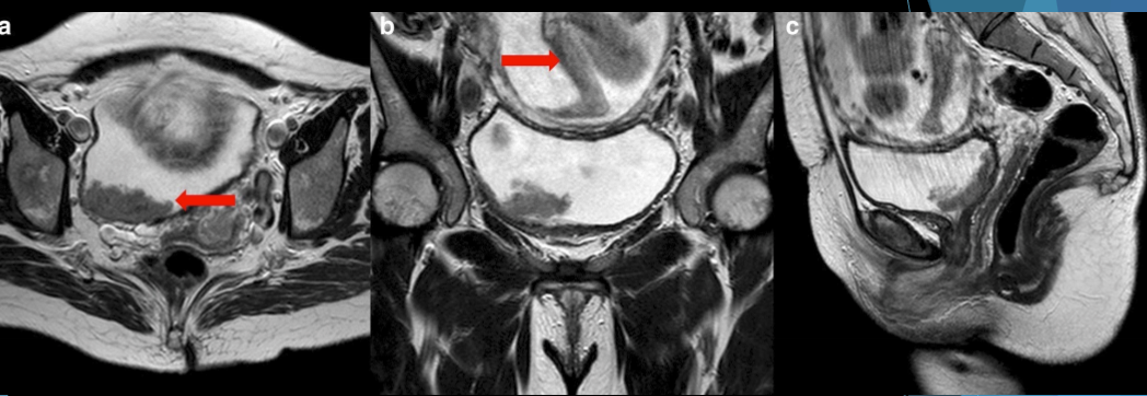 <p>What are these spots showing? </p>