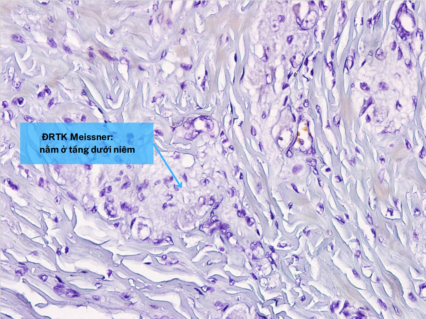 <p>Đám rối thần kinh Meissner </p>