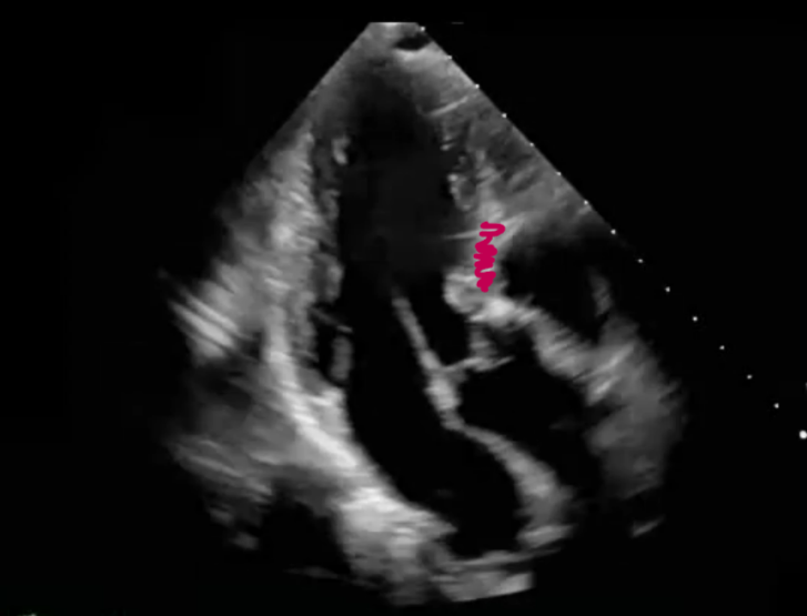 term image