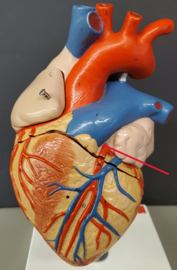 <p>Name the artery</p>